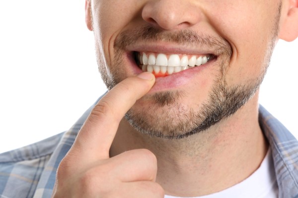 Types Of Treatment For Gum Disease